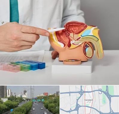 دکتر اورولوژی در توانیر