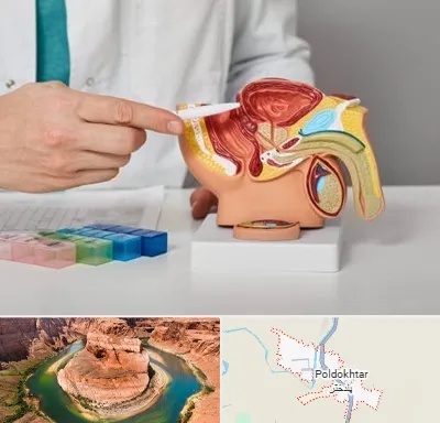 دکتر اورولوژی در پلدختر