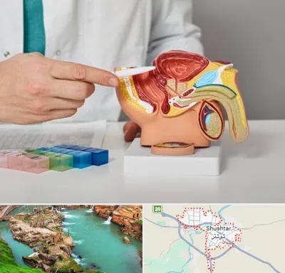 دکتر اورولوژی در شوشتر