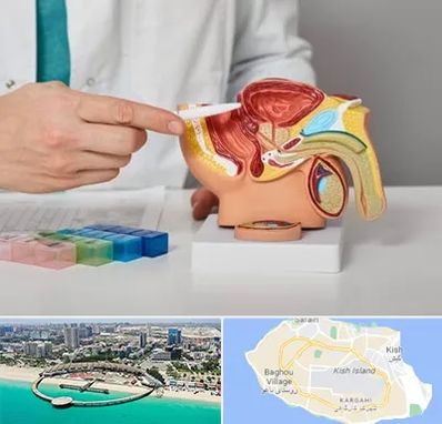 دکتر اورولوژی در کیش
