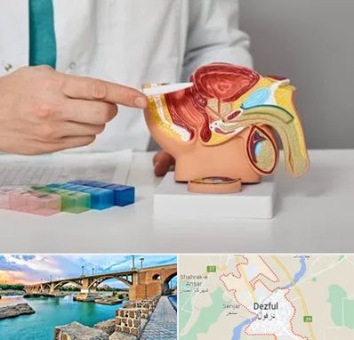 دکتر اورولوژی در دزفول