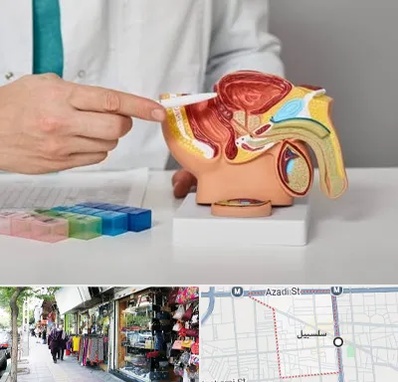 دکتر اورولوژی در سلسبیل