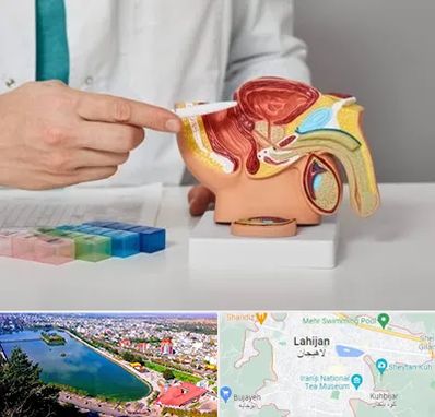 دکتر اورولوژی در لاهیجان