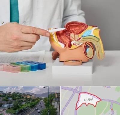 دکتر اورولوژی در لویزان