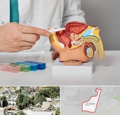 دکتر اورولوژی در جماران