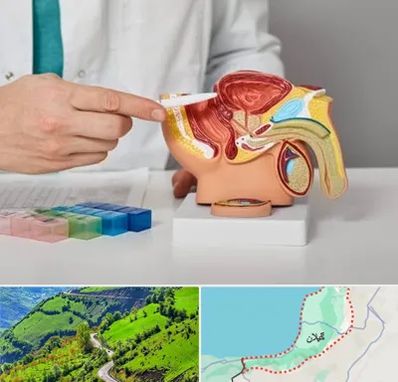 دکتر اورولوژی در گیلان