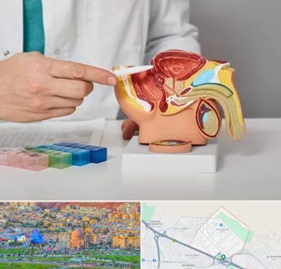 دکتر اورولوژی در رشدیه تبریز