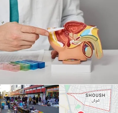 دکتر اورولوژی در شوش