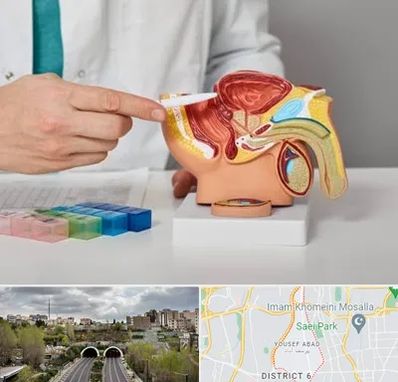 دکتر اورولوژی در یوسف آباد 