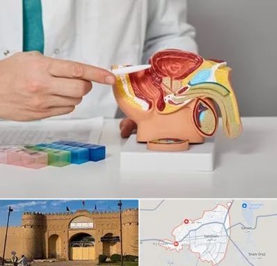 دکتر اورولوژی در ایرانشهر