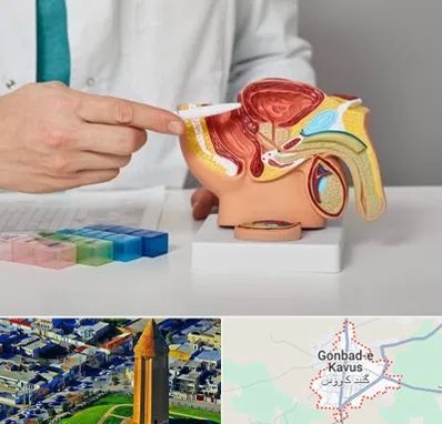 دکتر اورولوژی در گنبد کاووس