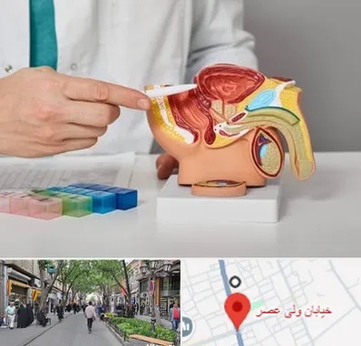 دکتر اورولوژی در ولیعصر شهریار