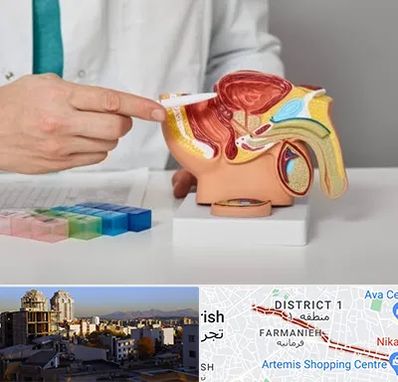 دکتر اورولوژی در فرمانیه 