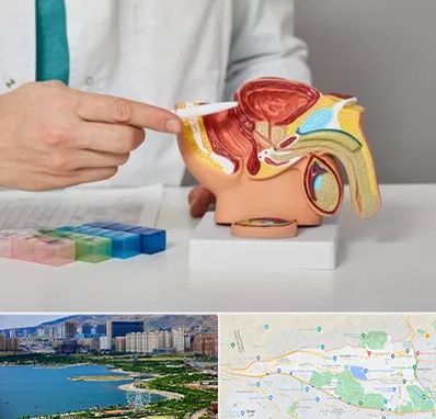 دکتر اورولوژی در منطقه 22 تهران 