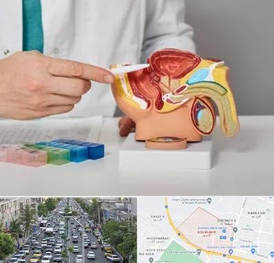 دکتر اورولوژی در گلشهر کرج 