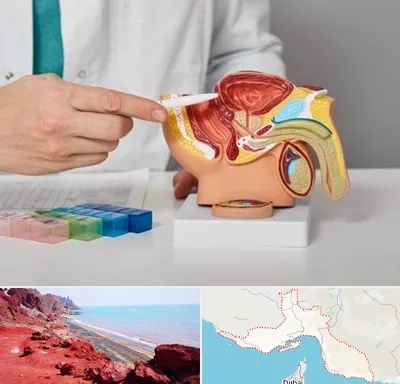 دکتر اورولوژی در هرمزگان