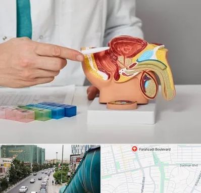 دکتر اورولوژی در بلوار فرحزادی