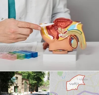 دکتر اورولوژی در دزاشیب