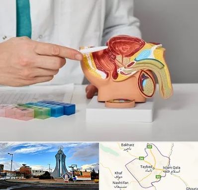 دکتر اورولوژی در تایباد