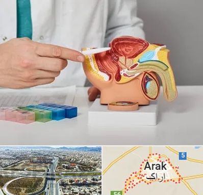دکتر اورولوژی در اراک