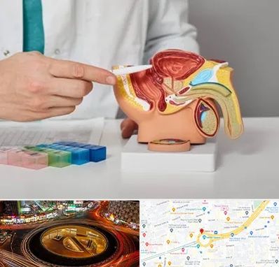 دکتر اورولوژی در میدان ولیعصر 