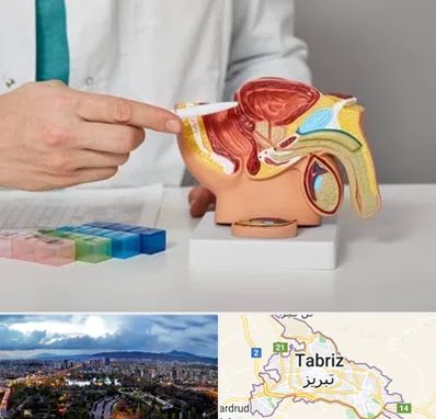 دکتر اورولوژی در تبریز