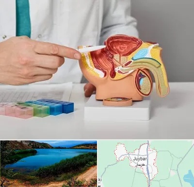 دکتر اورولوژی در جویبار