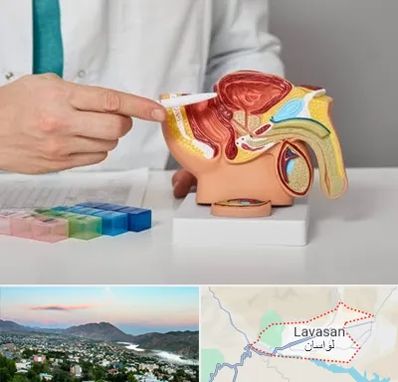 دکتر اورولوژی در لواسان