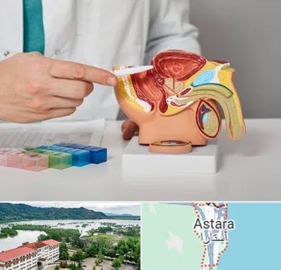 دکتر اورولوژی در آستارا