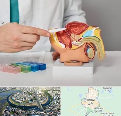 دکتر اورولوژی در بابل