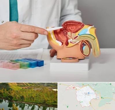 دکتر اورولوژی در بهبهان