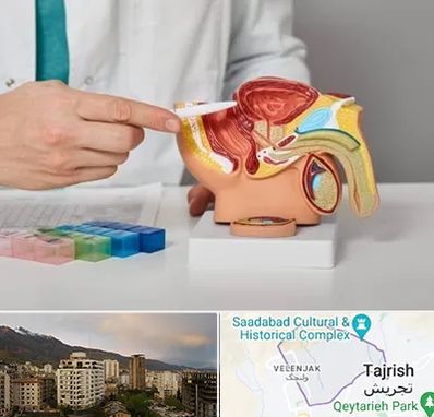 دکتر اورولوژی در زعفرانیه 