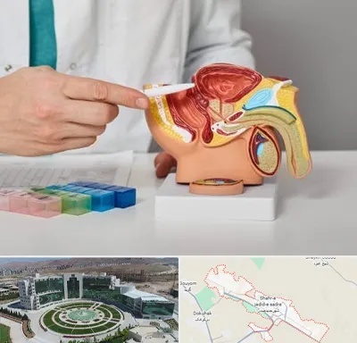 دکتر اورولوژی در صدرا