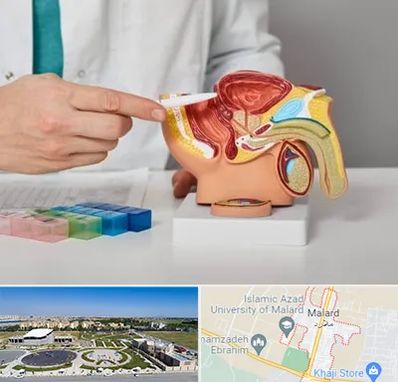 دکتر اورولوژی در ملارد