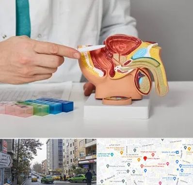 دکتر اورولوژی در فاطمی 