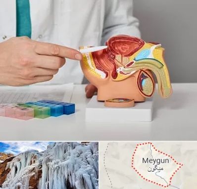 دکتر اورولوژی در میگون