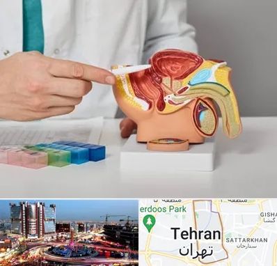 دکتر اورولوژی در صادقیه 