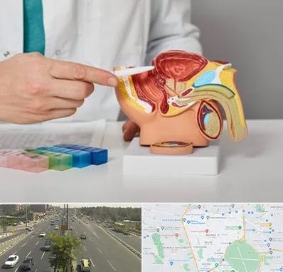 دکتر اورولوژی در منطقه 17 تهران 