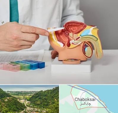 دکتر اورولوژی در چابکسر