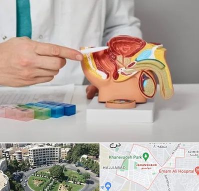 دکتر اورولوژی در جهانشهر کرج 