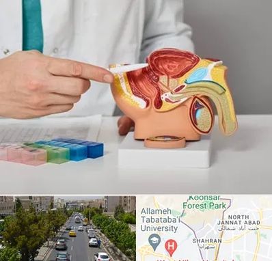 دکتر اورولوژی در شهران 