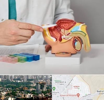 دکتر اورولوژی در عظیمیه کرج 