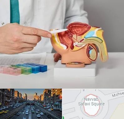 دکتر اورولوژی در نواب 