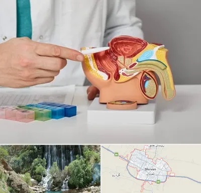 دکتر اورولوژی در شیروان