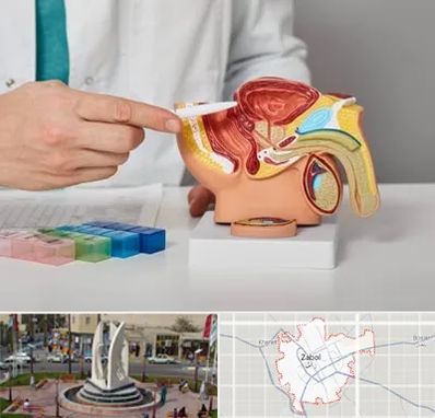 دکتر اورولوژی در زابل