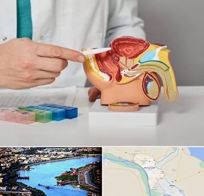 دکتر اورولوژی در خرمشهر