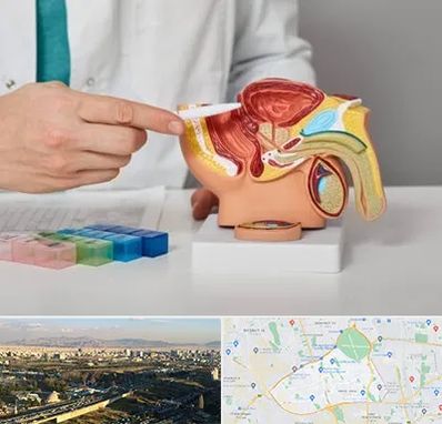 دکتر اورولوژی در منطقه 19 تهران 