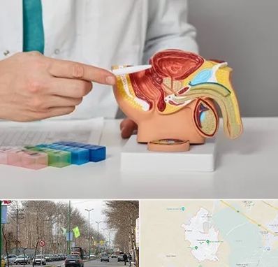 دکتر اورولوژی در نظرآباد کرج 