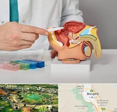 دکتر اورولوژی در بروجرد