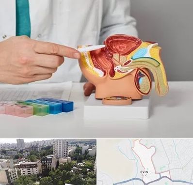 دکتر اورولوژی در اوین